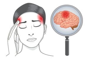 Woman with headaches symptom - TeleLeaf RX