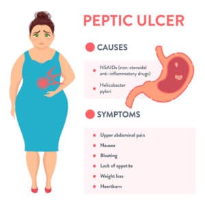 cause of severe nausea - peptic ulcer