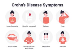 Symptoms of Crohn's Disease-TeleLeaf RX