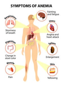 Symptoms of anemia - Tele Leaf RX